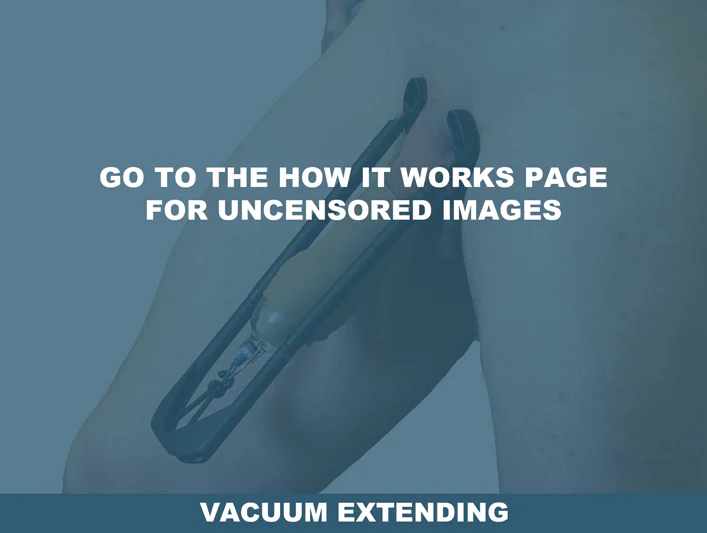The Ultimate Package - Hanger + Stretcher - Image 26